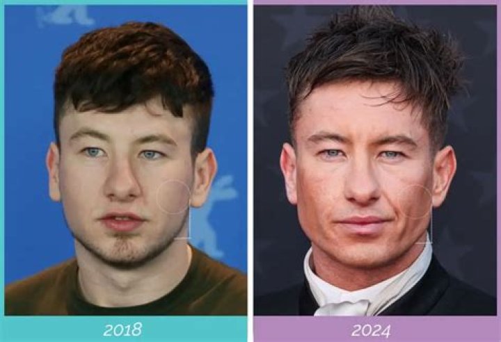 Exploring Barry Keoghan's Ethnicity: The Story Behind The Rising Star