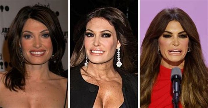The Evolution Of Kimberly Guilfoyle's Facial Features