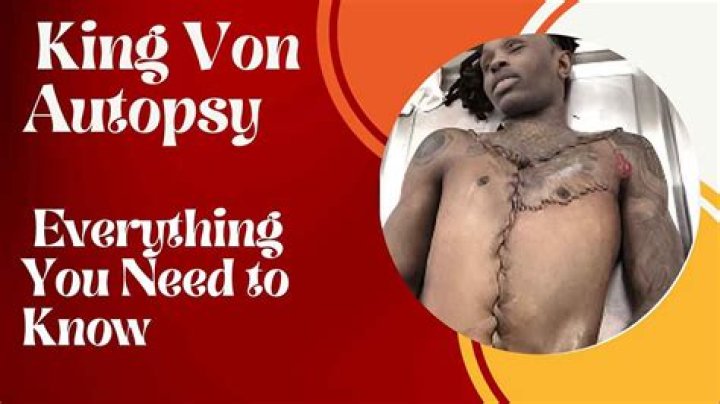 King Von Autopsy Report: Unveiling The Tragic End Of A Rising Star