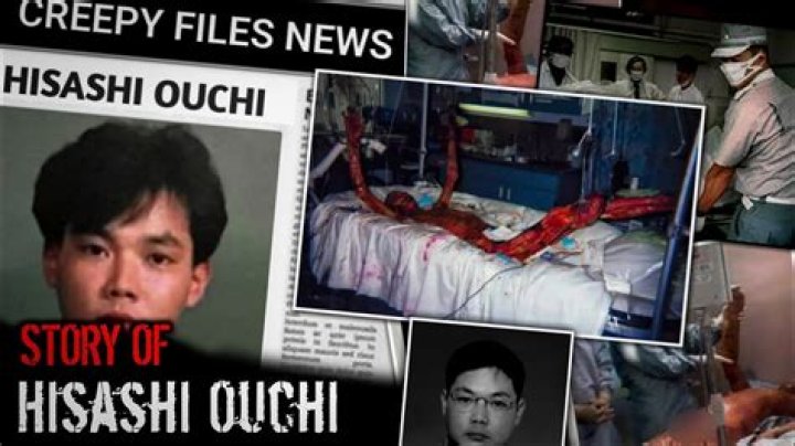 Unveiling The Truth: Hisashi Ouchi Real Photos And Their Impact